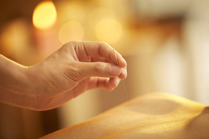 Acupuncture and Tuina