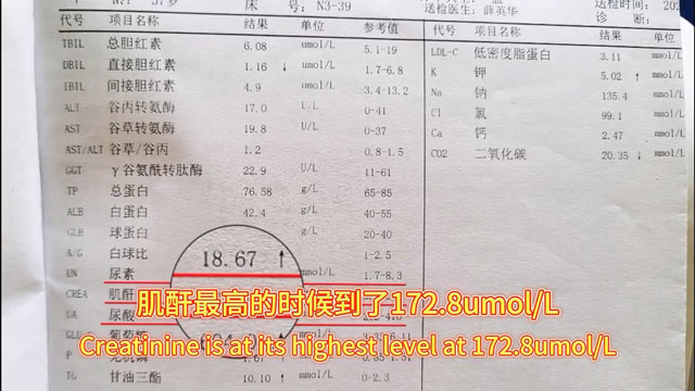 Thought Cured But Struck by Relapse! An 18-Year Kidney Disease Patient Reborn
