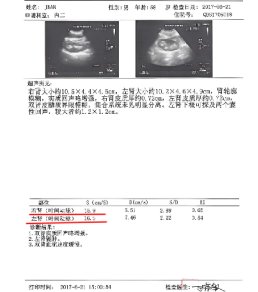 JEAN's ultrasound report at admission
