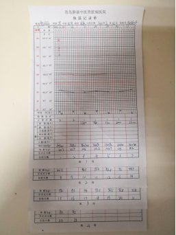 Mr. Zhang's severe bilateral lower limb edema before treatment