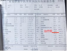 Before and after treatment comparison