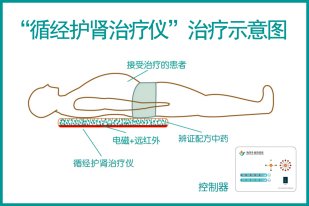 Meridian Kidney-Protection Therapy Device in treatment